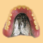 コバルトクロム床義歯　イメージ画像
