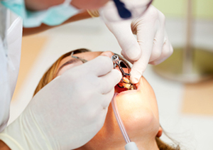 お口の中の外科治療は口腔外科へ イメージ画像